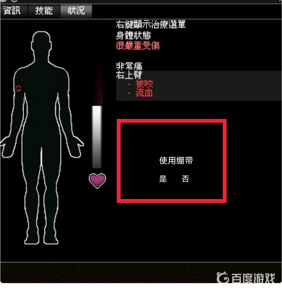 僵屍毀滅工程咬傷必死嗎？